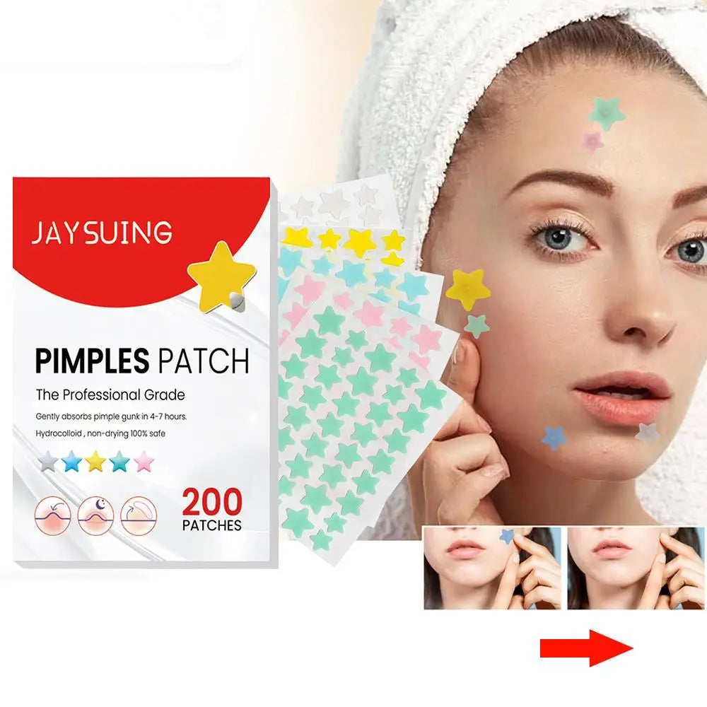 Invisible Acne Pimple Patch (200pcs/set): Professional Skin Care for Repairing, Healing, and Absorbing Acne Spots