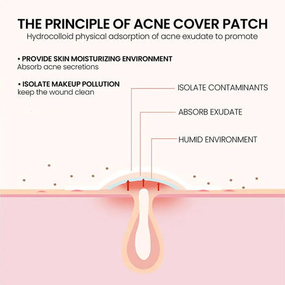 Invisible Acne Pimple Patch (200pcs/set): Professional Skin Care for Repairing, Healing, and Absorbing Acne Spots